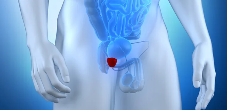 Problemas na Próstata | Dr Luiz Takano Especialista em Urologia Minimamente Invasiva