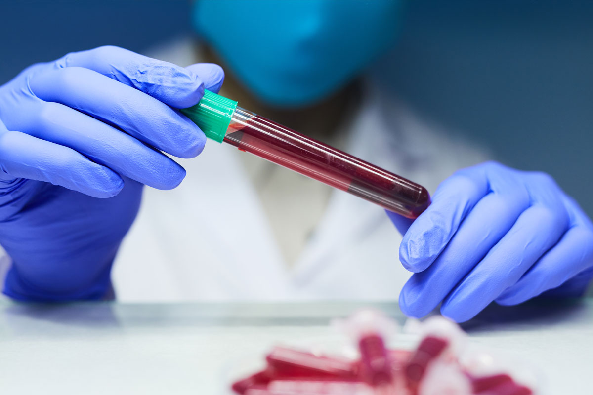 Exames de sangue podem evitar biopsia da próstata