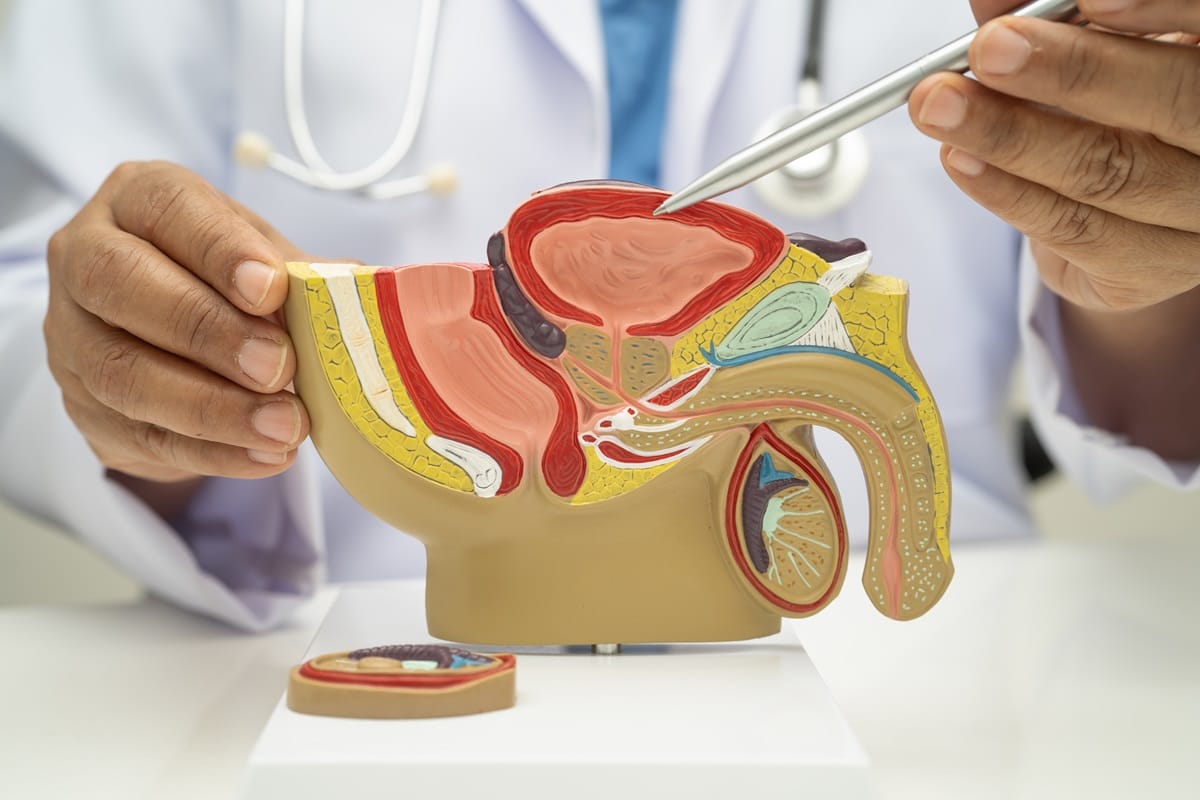Câncer de Bexiga importância da segunda opinião médica