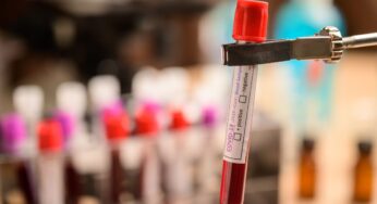Teste Sanguíneo pode prever a sobrevida do paciente com câncer de próstata metastático
