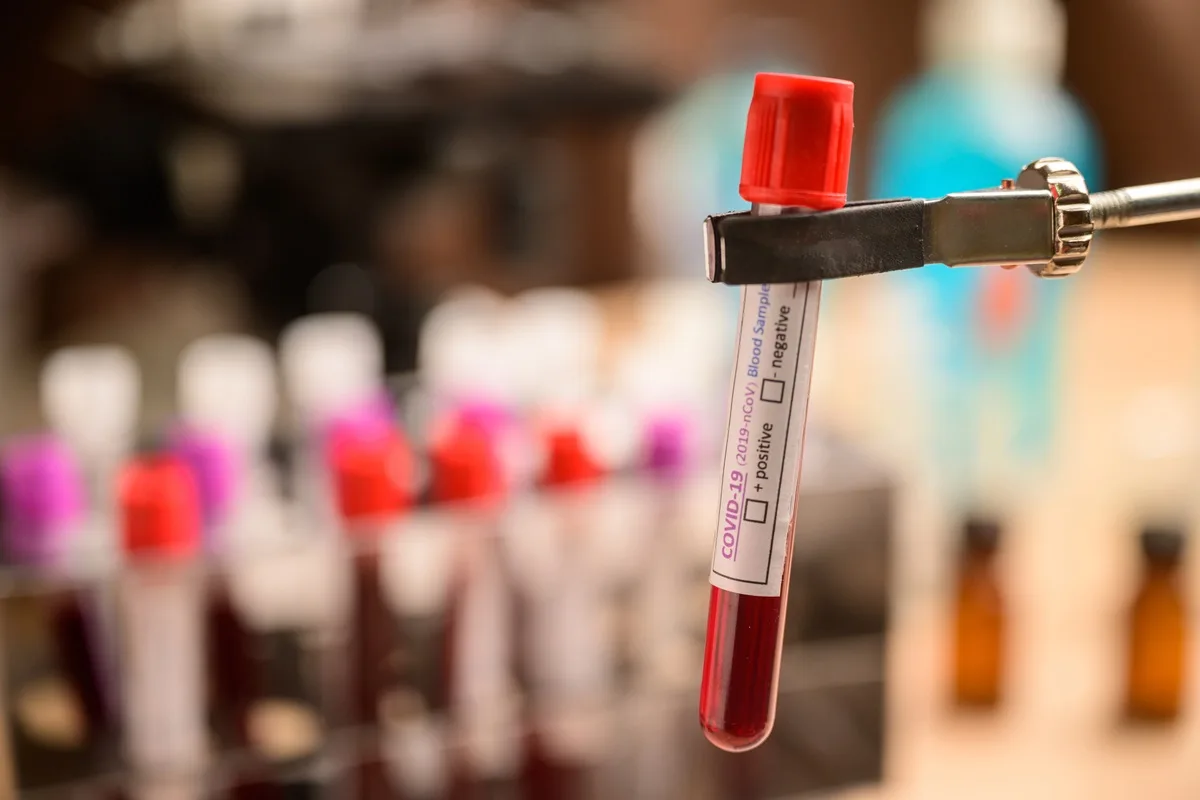 Teste Sanguíneo pode prever a sobrevivência com o câncer de próstata metastático