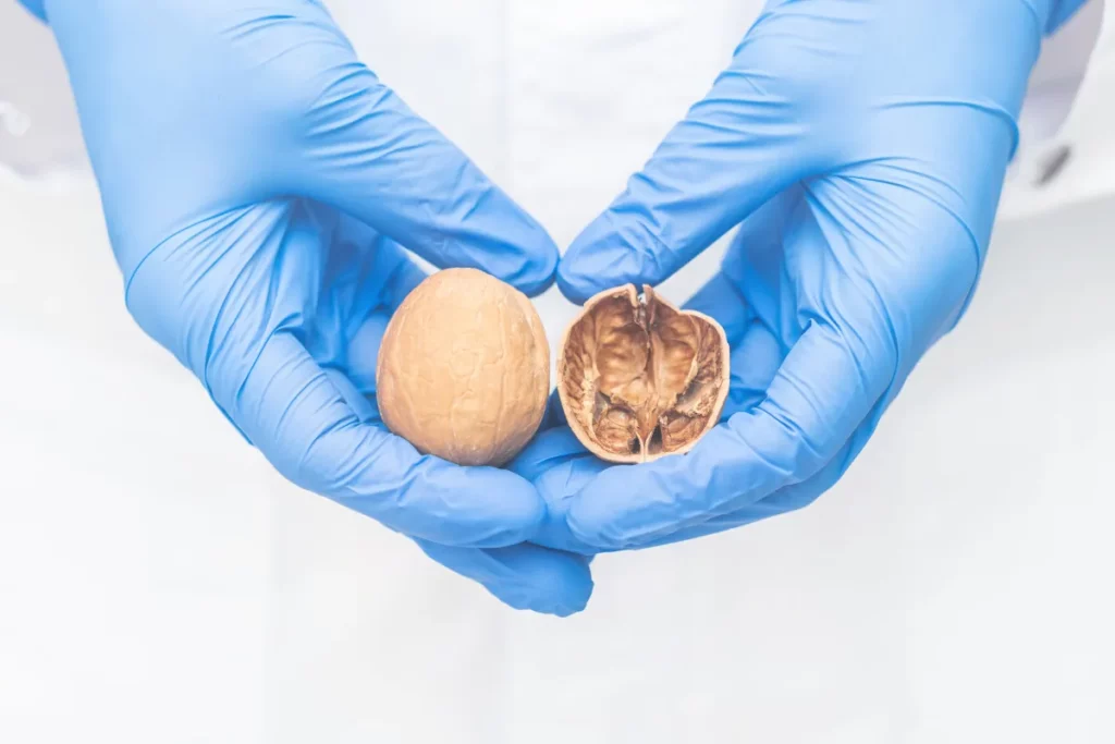 mãos de médico segurando testículo de plastico
