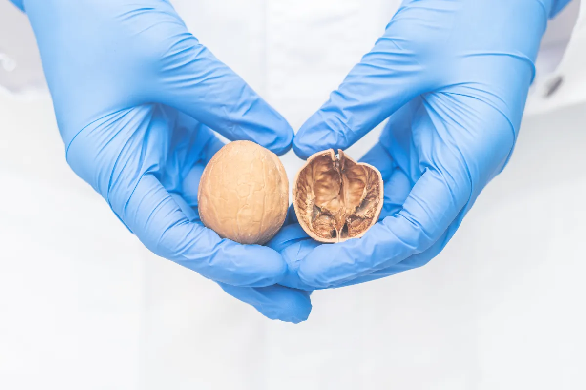 mãos de médico segurando testículo de plastico